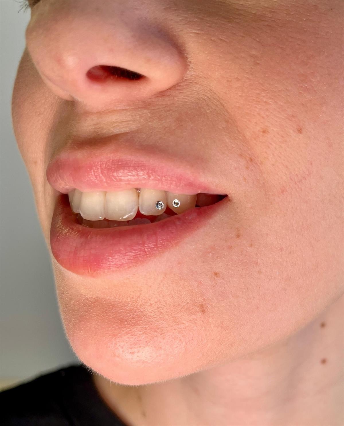 Detalle de gemas dentales realizado en Mamba Tattoo Estudio