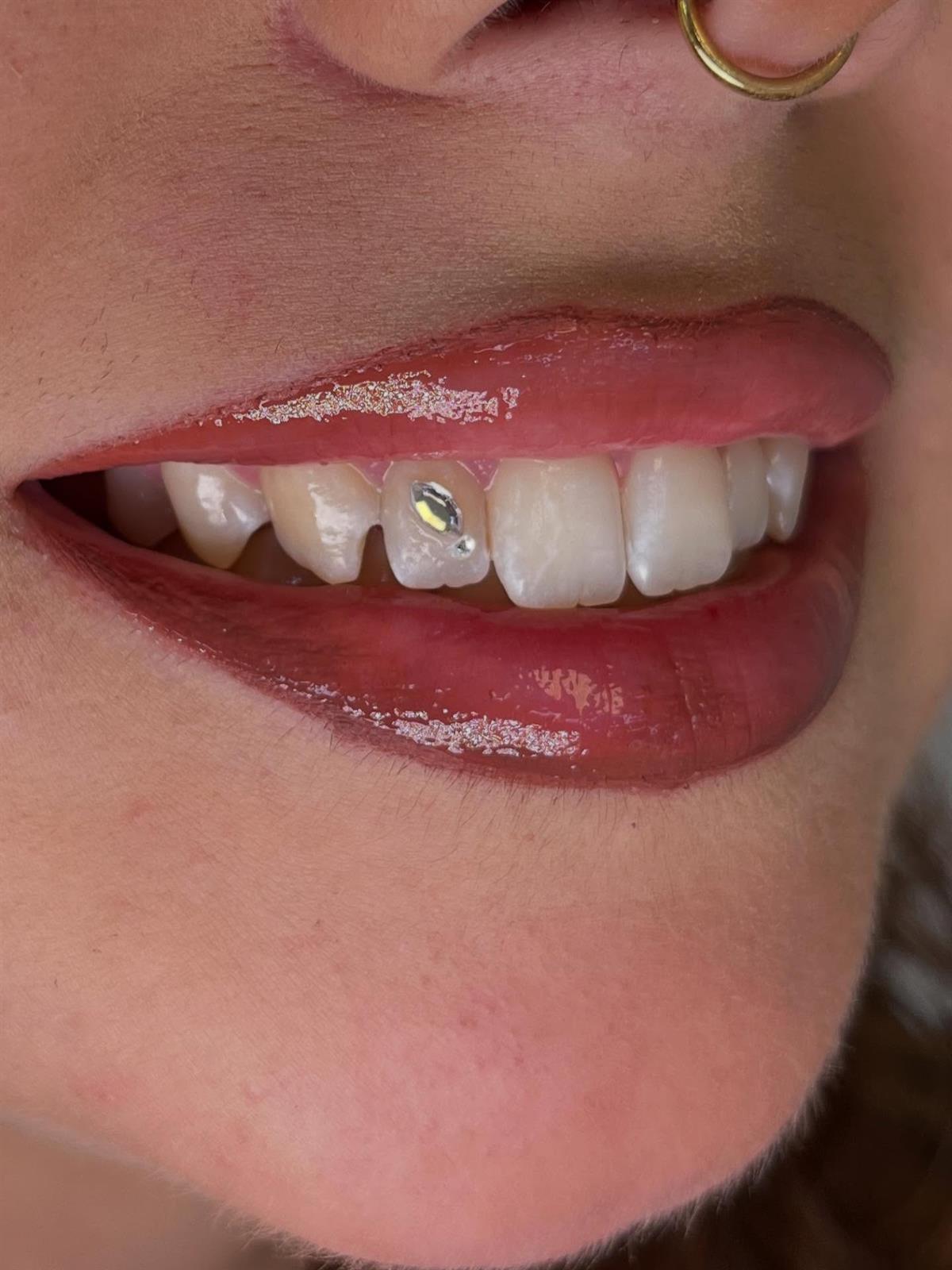 Aplicaci&oacute;n de gemas dentales en Mamba Tattoo Estudio